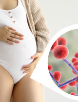 Vaginálna mykóza v tehotenstve – prečo je u tehotných žien vyššie riziko a ako postupovať pri liečbe?