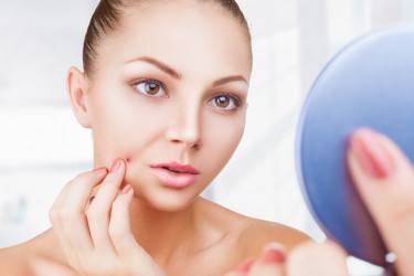 TOP bylinky na kožné problémy: Ktoré zatočia s akné, mastnou pleťou či ekzémom?