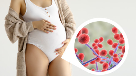 Vaginálna mykóza v tehotenstve – prečo je u tehotných žien vyššie riziko a ako postupovať pri liečbe?