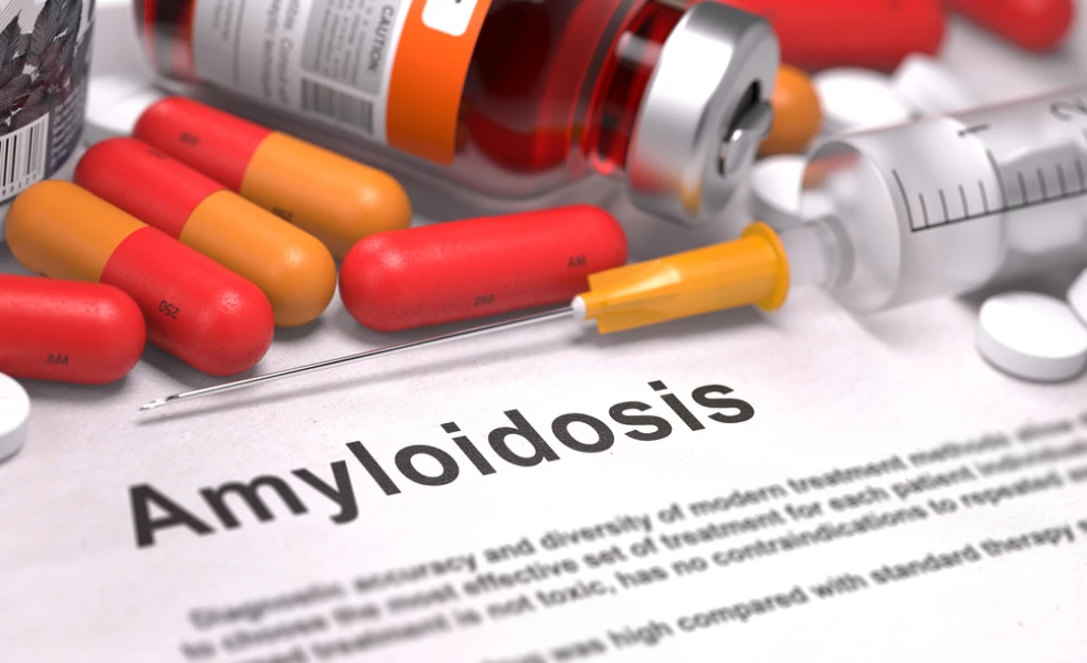 Amyloidóza