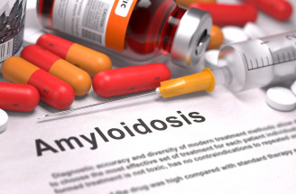 Amyloidóza: Zriedkavá choroba, ktorá ohrozuje rôzne vnútorné orgány