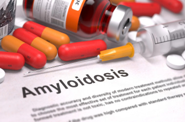 Amyloidóza: Zriedkavá choroba, ktorá ohrozuje rôzne vnútorné orgány