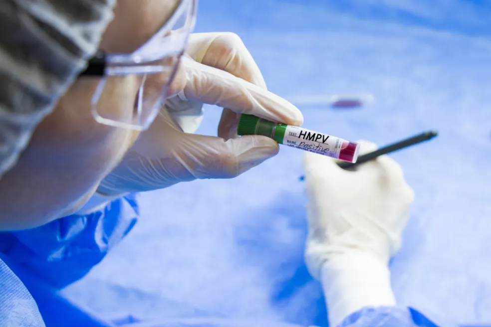 Diagnostika hMPV infekcie