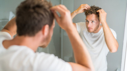 Mastná pokožka hlavy – zistite, čo ju spôsobuje a ako proti tomu zabojovať!