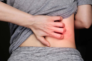 Preležaniny alebo dekubity: Kto je najviac ohrozený a ako im predísť?