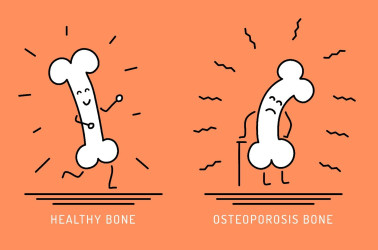 Aké sú rizikové faktory osteoporózy? Na toto treba dávať pozor!