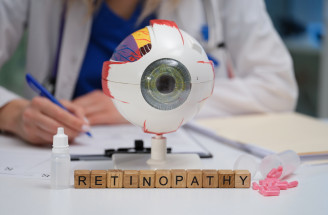 Ak sa cukrovka nelieči, môže vzniknúť diabetická retinopatia. O aký problém ide?