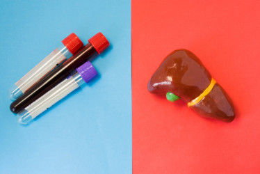 Pečeňové testy: Čo odhalia a ako sa na ne pripraviť?