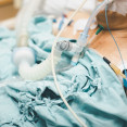 Umelá pľúcna ventilácia – kedy je nevyhnutná a aké sú jej riziká?