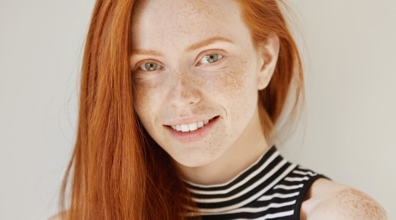 Dermatológovia radia: Ako odlíšiť nebezpečné znamienko od pieh?