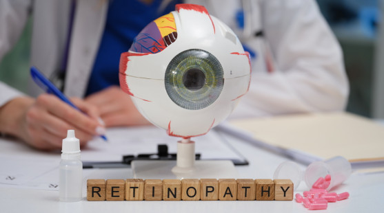 Ak sa cukrovka nelieči, môže vzniknúť diabetická retinopatia. O aký problém ide?