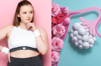 Chudnutie pri PCOS môže byť náročné. Prečo sa vás kilá držia a čo s tým urobiť?