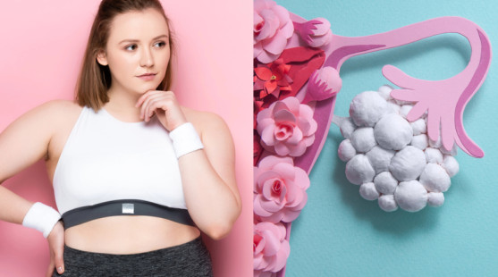 Chudnutie pri PCOS môže byť náročné. Prečo sa vás kilá držia a čo s tým urobiť?