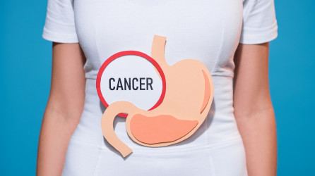 Rakovina žalúdka – aké sú príznaky, príčiny, spôsob diagnostiky a možnosti liečby?