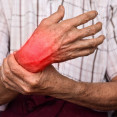 Artritída môže prepuknúť vo viacerých formách. Aké typy rozlišujeme a čo príznaky?