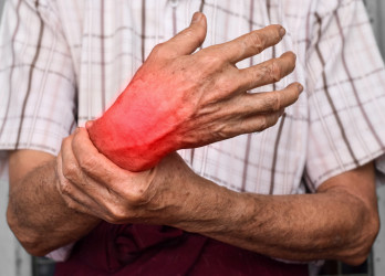 Artritída môže prepuknúť vo viacerých formách. Aké typy rozlišujeme a čo príznaky?