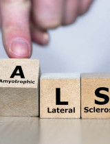 ALS choroba: Vážne ochorenie nervového systému, ktoré mení život. Čo o ňom vedieť?
