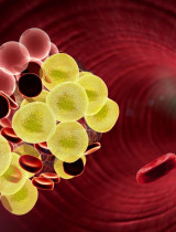 Krvné zrazeniny – čo zvyšuje riziko ich výskytu a ako im predchádzať?