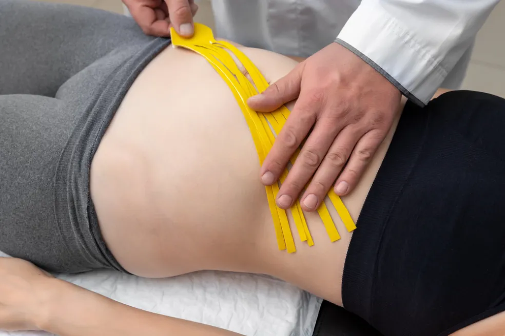 Liečba a riešenie brušnej diastázy