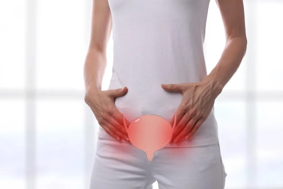 Infekcie močových ciest