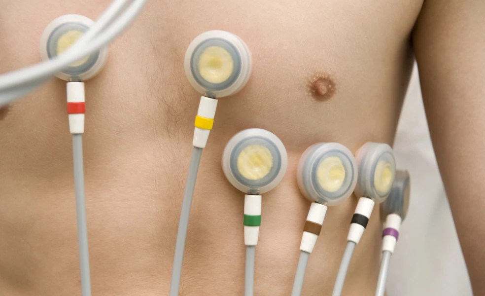 EKG vyšetrenie