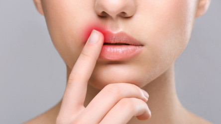 Herpes na pere: Aké sú jeho príčiny a následná liečba?