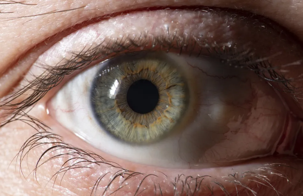 Príznaky očného melanómu