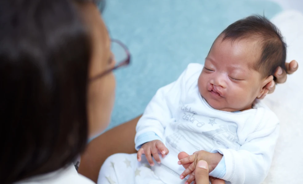 Rázštep pery a podnebia