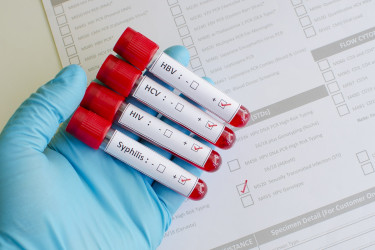 Nepríjemné pohlavne prenosné choroby: Čo by sme o nich mali vedieť?