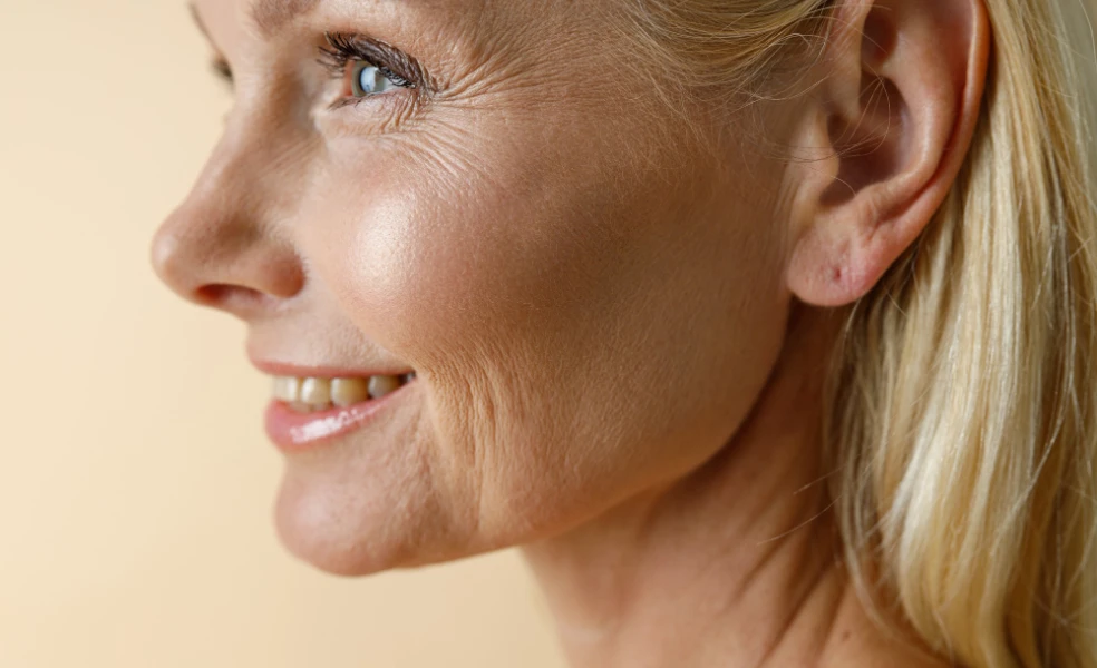 starnutie pleti a pokožky