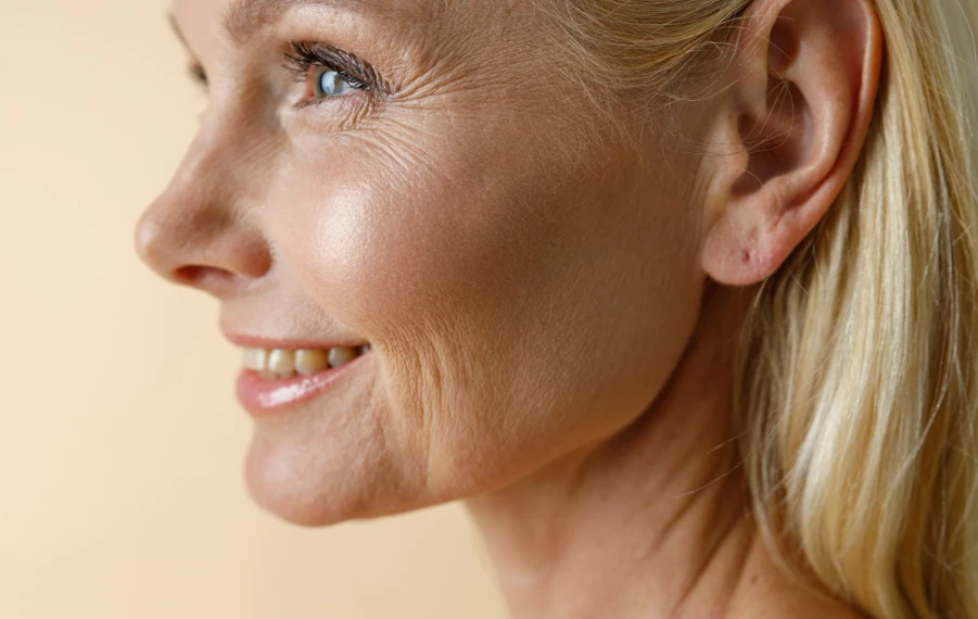 starnutie pleti a pokožky