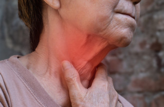 Závažná rakovina hrtana – tieto bežné faktory zvyšujú riziko jej vzniku!