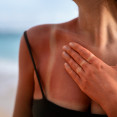 Ako sa nespáliť na slnku: Reálne tipy, ktoré fungujú lepšie než SPF 50