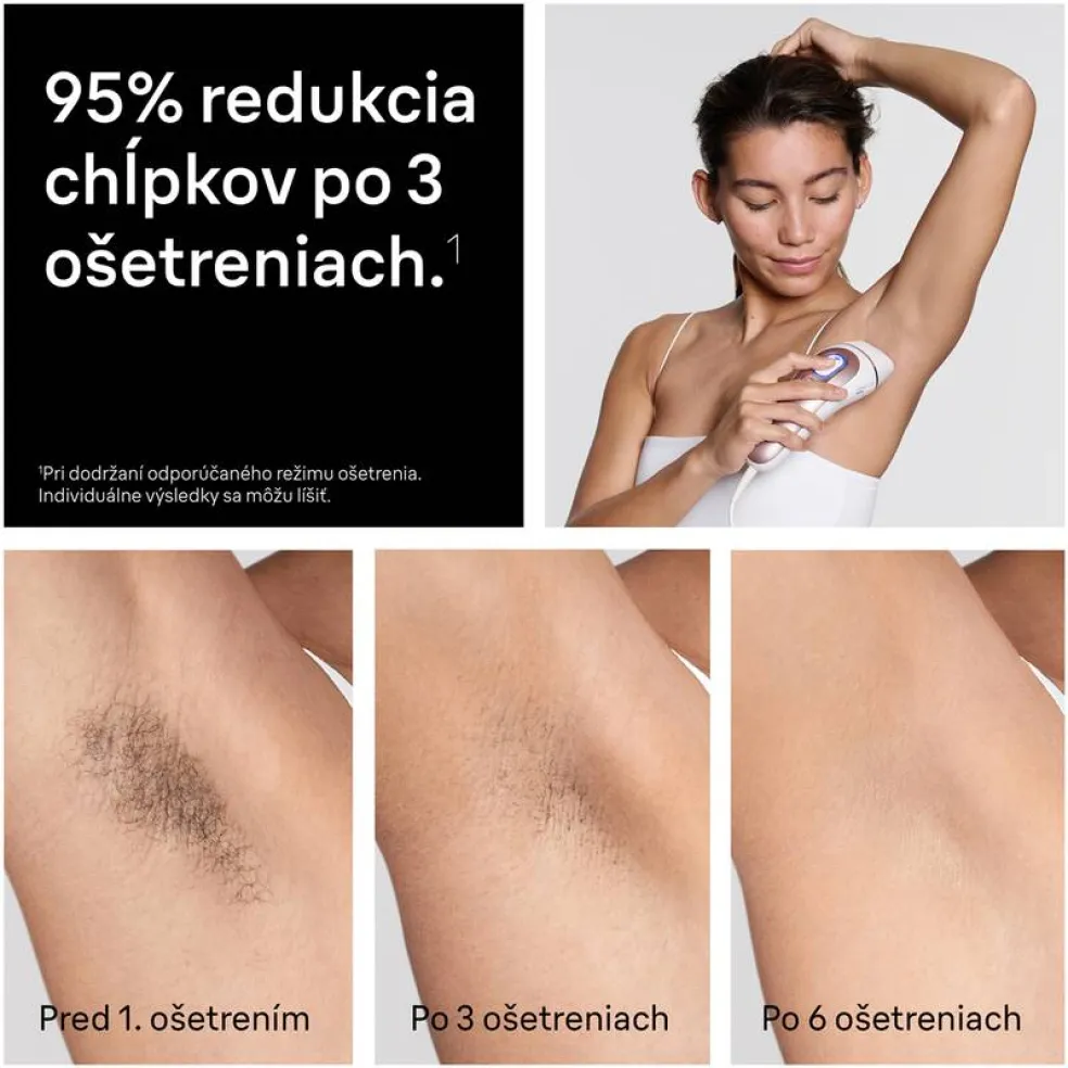 Žena používa Braun IPL epilátor na podpazušie