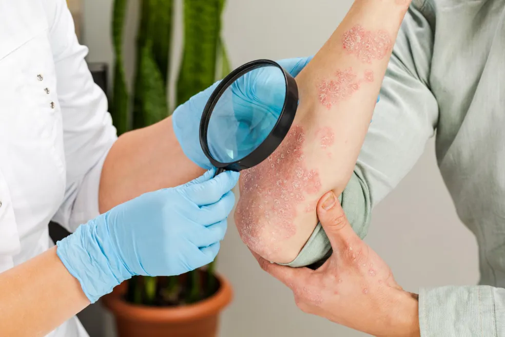 Dermatológ vyšetruje kožnú vyrážku na ruke pacienta